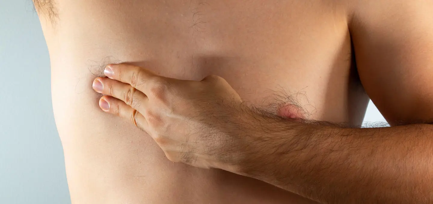 Ahid Abood Plastic Surgery - Male Breasts