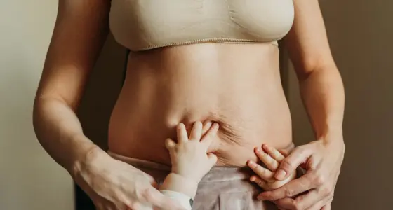 Ahid Abood Plastic Surgery - Post Pregnancy
