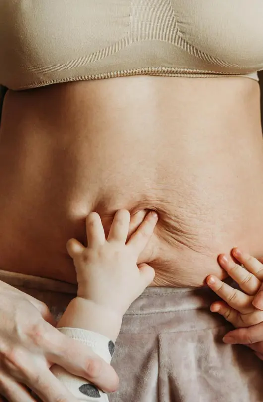 Ahid Abood Plastic Surgery - Post Pregnancy