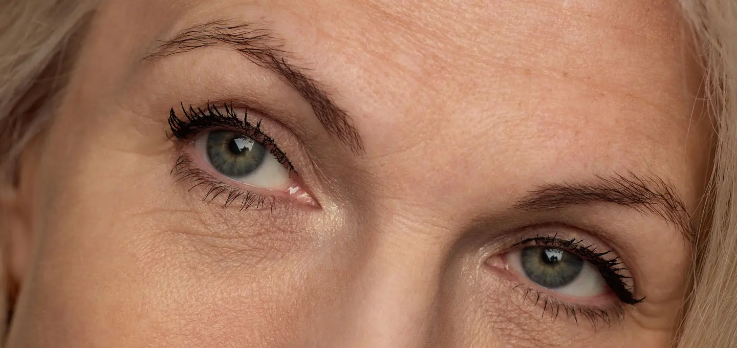 AA Plastic Surgery - Brow Lift