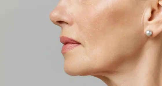AA Plastic Surgery - Drooping Mid-Face & Cheek Descent