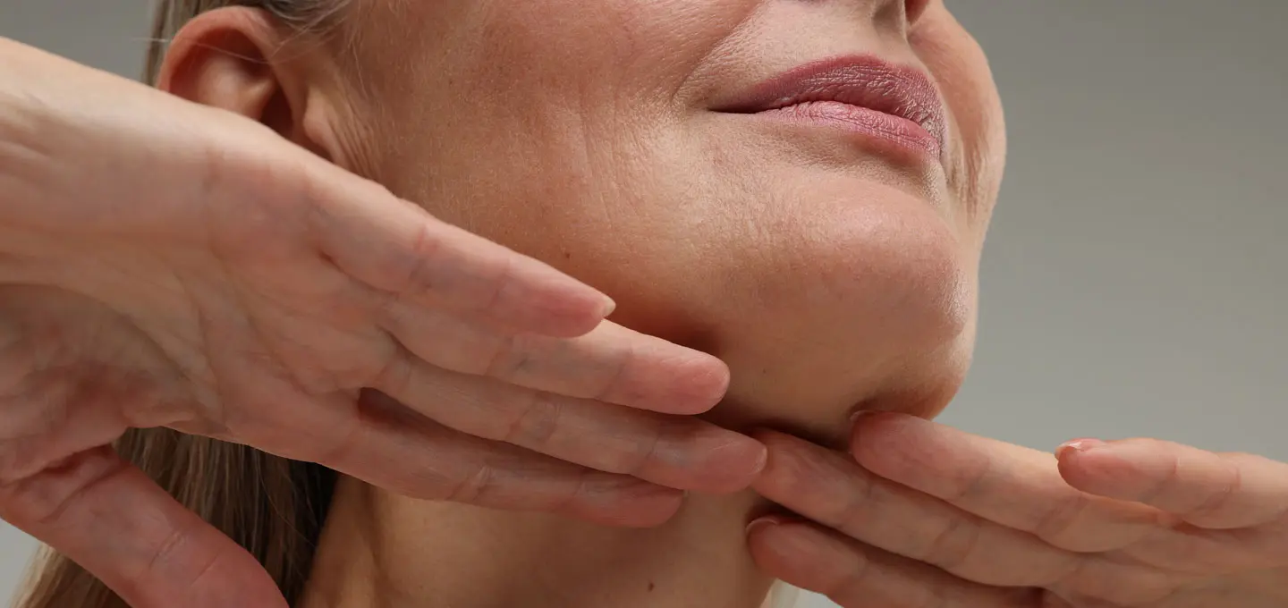 AA Plastic Surgery - Jowls & Jawline Sagging