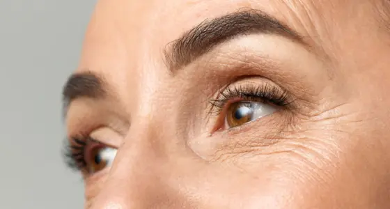 AA Plastic Surgery - Upper Face Ageing