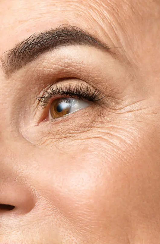 AA Plastic Surgery - Upper Face Ageing